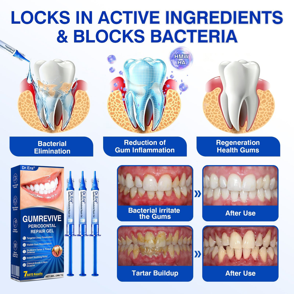 🇨🇦🏆🦷✨Dr.Era® GumRevive Periodontal Repair Gel
