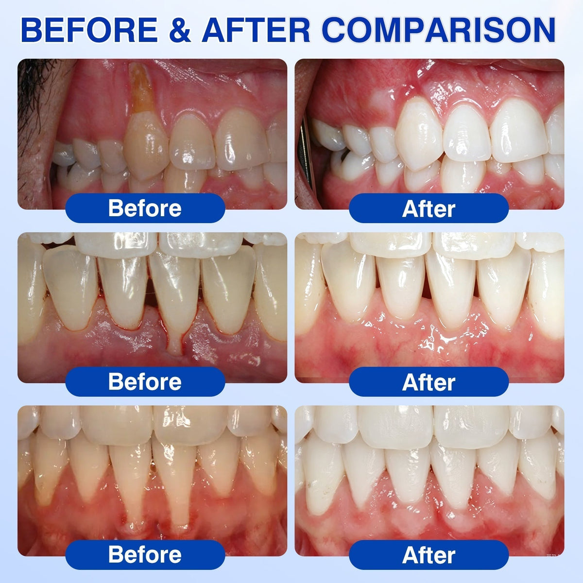 🇨🇦🏆🦷✨Dr.Era® GumRevive Periodontal Repair Gel