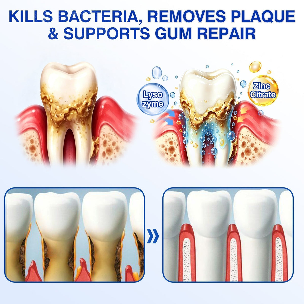 🇨🇦🏆🦷✨Dr.Era® GumRevive Periodontal Repair Gel