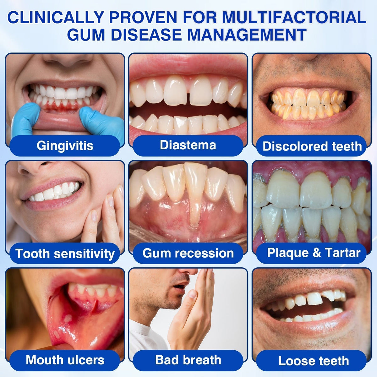 🇨🇦🏆🦷✨Dr.Era® GumRevive Periodontal Repair Gel