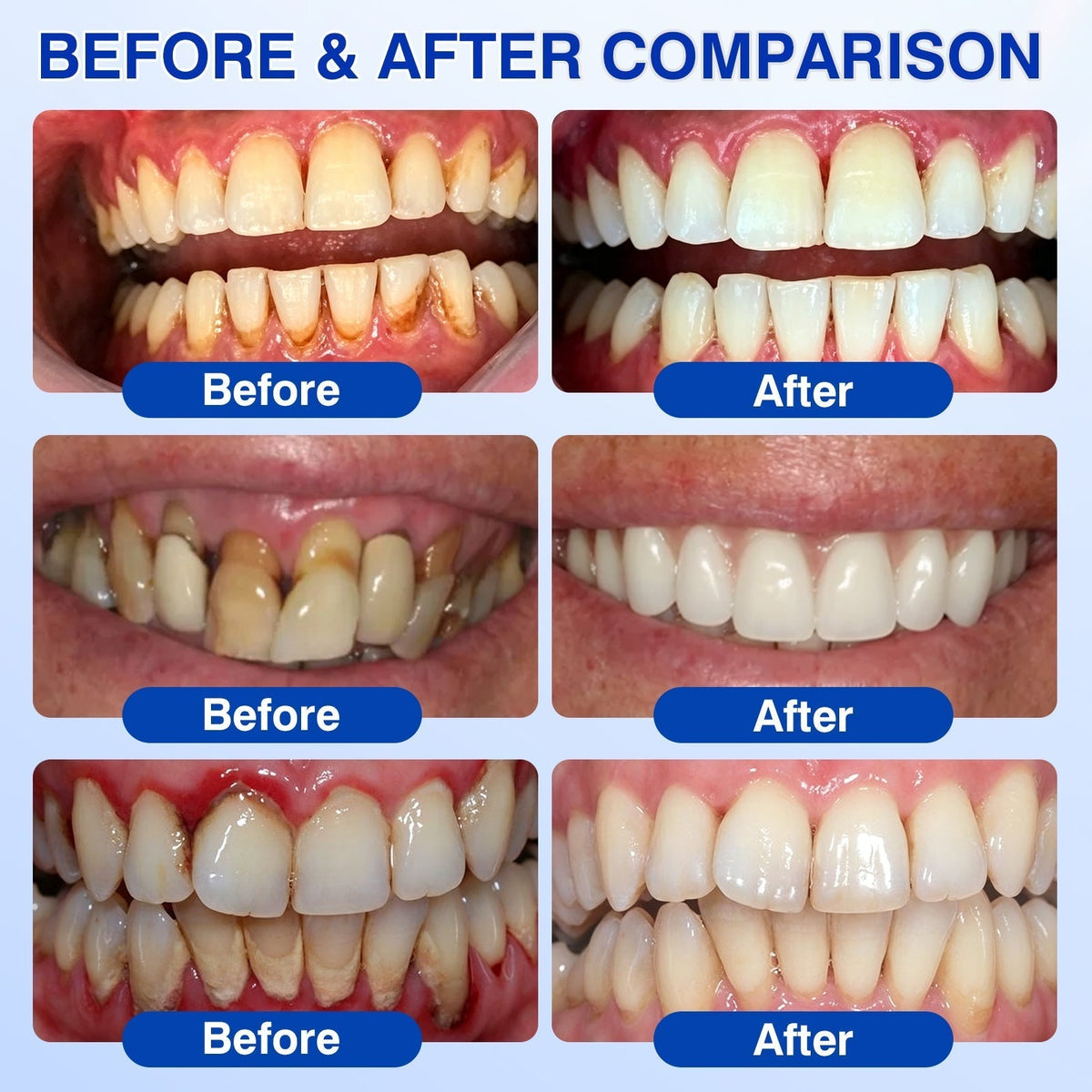 🇨🇦🏆🦷✨Dr.Era® GumRevive Periodontal Repair Gel