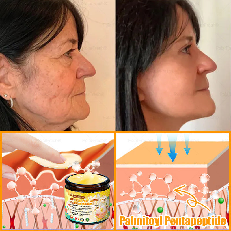 🔥 Made & Shipped from CA | Clinically Proven: PolarFresh® Bee Venom Wrinkle-Firming Multi-purpose Cream with bee venom peptides, botulinum toxin, hyaluronic acid, and collagen💧. Targets wrinkles, fine lines, sagging, stretch marks, dark spots and more