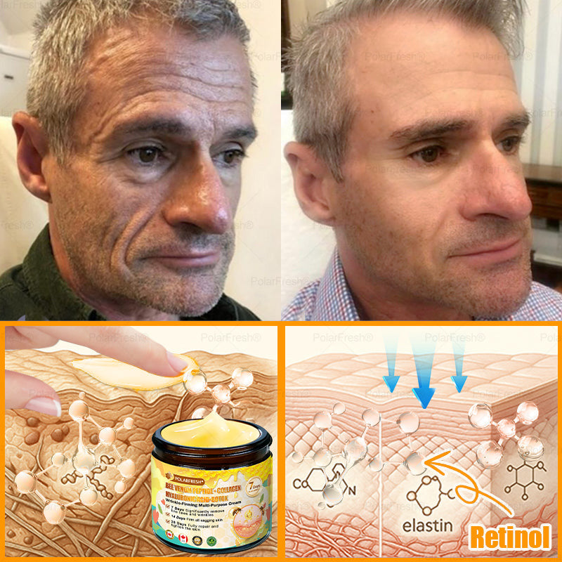 🔥 Made & Shipped from CA | Clinically Proven: PolarFresh® Bee Venom Wrinkle-Firming Multi-purpose Cream with bee venom peptides, botulinum toxin, hyaluronic acid, and collagen💧. Targets wrinkles, fine lines, sagging, stretch marks, dark spots and more