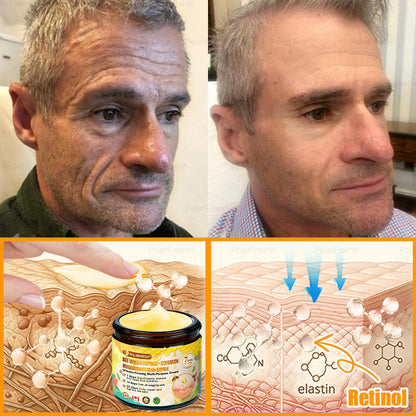 🔥 Made & Shipped from CA | Clinically Proven: PolarFresh® Bee Venom Wrinkle-Firming Multi-purpose Cream with bee venom peptides, botulinum toxin, hyaluronic acid, and collagen💧. Targets wrinkles, fine lines, sagging, stretch marks, dark spots and more