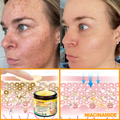 🔥 Made & Shipped from CA | Clinically Proven: PolarFresh® Bee Venom Wrinkle-Firming Multi-purpose Cream with bee venom peptides, botulinum toxin, hyaluronic acid, and collagen💧. Targets wrinkles, fine lines, sagging, stretch marks, dark spots and more