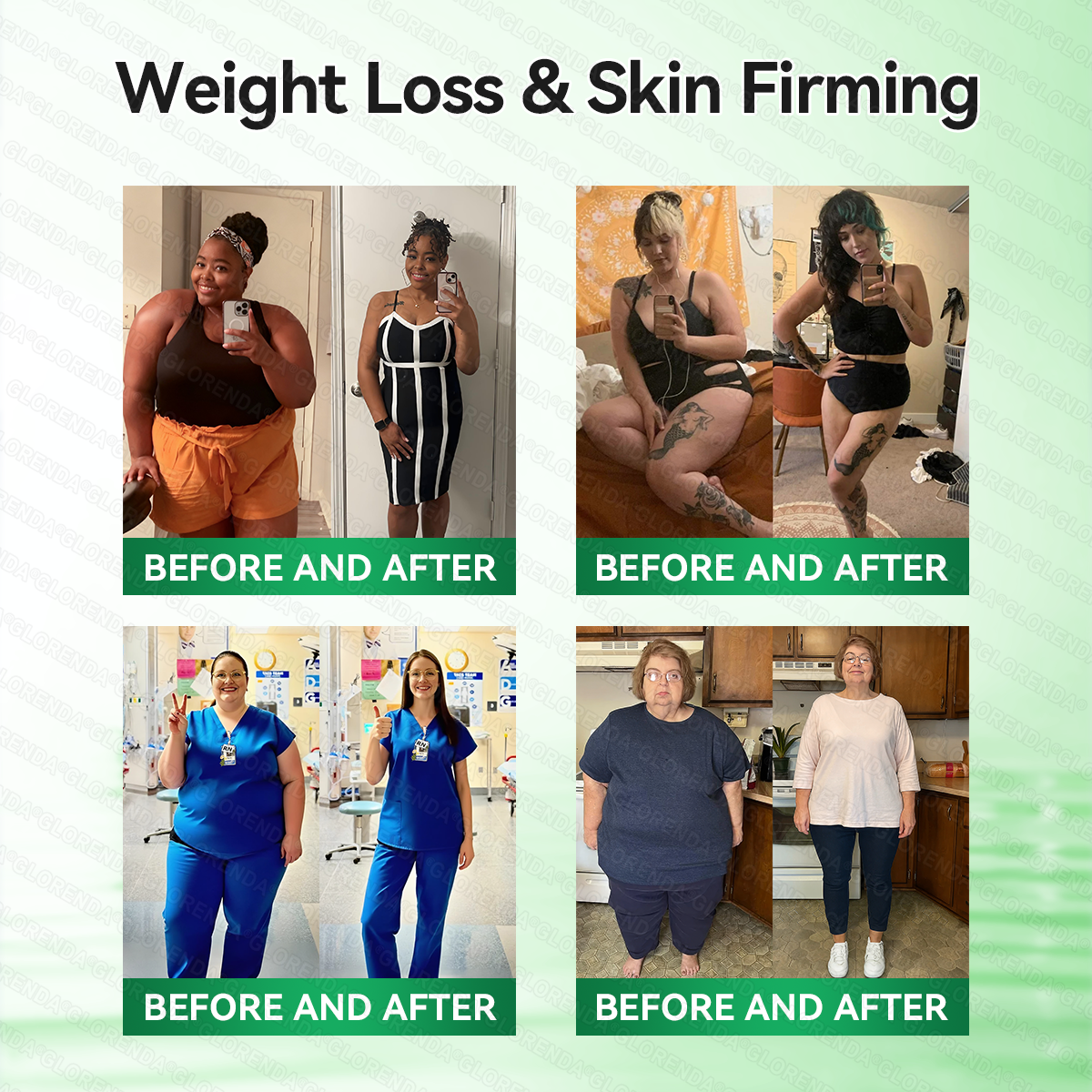 𝑶𝒇𝒇𝒊𝒄𝒊𝒂𝒍 𝑺𝒕𝒐𝒓𝒆  | 💖 𝐂𝐚𝐫𝐞𝐔𝐩𝐥𝐢𝐟𝐭® 𝙈𝒐𝒓𝒊𝒏𝒈𝗮 · 𝗕𝗲𝗿𝗯𝐞𝐫𝐢𝐧𝙚 × 𝙉𝑨𝑫+ 𝟏𝟎-𝙞𝙣-𝟏 𝘼𝒅𝒗𝒂𝒏𝒄𝒆𝐝 𝐍𝐚𝐧𝙤 𝙈𝙞𝙘𝙧𝙤𝙣𝒆𝒆𝒅𝒍𝐞 𝐏𝐚𝐭𝙘𝙝(𝐉𝐮𝐬𝐭 𝐨𝐧𝐜𝐞 𝐚 𝐝𝐚𝐲, 𝐯𝐢𝐬𝐢𝐛𝐥𝐞 𝐜𝐡𝐚𝐧𝐠𝐞𝐬 𝐢𝐧 𝟕 𝐝𝐚𝐲𝐬） ✅ 𝐅𝐨𝐫 𝐨𝐛𝐞𝐬𝐢𝐭𝐲, 🅛🅞🅞🅢🅔 🅢🅚🅘🅝,𝐝𝐢𝐚𝐛𝐞𝐭𝐞𝐬, 𝐬𝐥𝐞𝐞𝐩 𝐚𝐩𝐧𝐞𝐚, 𝐣𝐨𝐢𝐧𝐭 𝐢𝐬𝐬𝐮𝐞𝐬, 𝐚𝐧𝐝 𝐦𝐨𝐫e