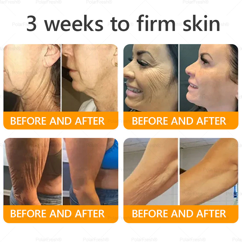 🔥 Made & Shipped from CA | Clinically Proven: PolarFresh® Bee Venom Wrinkle-Firming Multi-purpose Cream with bee venom peptides, botulinum toxin, hyaluronic acid, and collagen💧. Targets wrinkles, fine lines, sagging, stretch marks, dark spots and more
