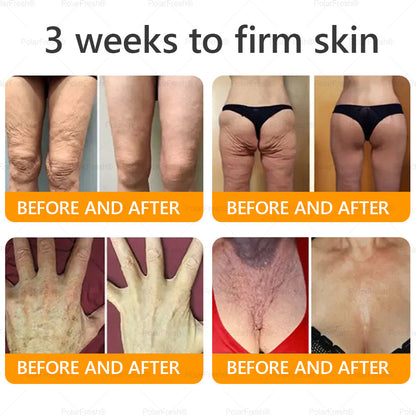 🔥 Made & Shipped from CA | Clinically Proven: PolarFresh® Bee Venom Wrinkle-Firming Multi-purpose Cream with bee venom peptides, botulinum toxin, hyaluronic acid, and collagen💧. Targets wrinkles, fine lines, sagging, stretch marks, dark spots and more